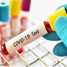 Testovanie  na  ochorenie Covid-19